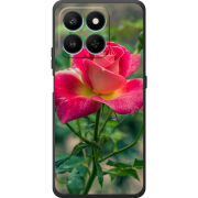 Чохол BoxFace Honor 400 Smart 