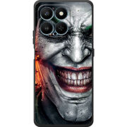 Чохол BoxFace Honor 400 Smart Prankster