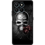 Чохол BoxFace Honor 400 Smart 