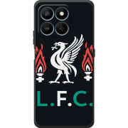 Чохол BoxFace Honor 400 Smart L. F. C.