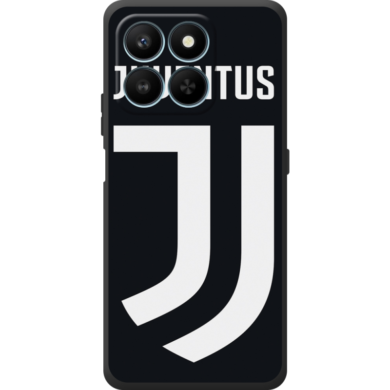 Чохол BoxFace Honor 400 Smart FC J