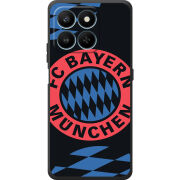 Чохол BoxFace Honor 400 Smart FC Bayern