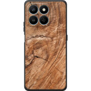 Чохол BoxFace Honor 400 Smart 