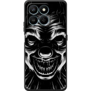 Чохол BoxFace Honor 400 Smart 