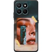 Чохол BoxFace Honor 400 Smart 