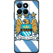 Чохол BoxFace Honor 400 Smart 