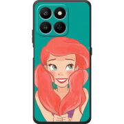 Чохол BoxFace Honor 400 Smart 