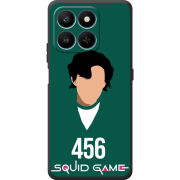 Чохол BoxFace Honor 400 Smart siquid game 456