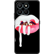 Чохол BoxFace Honor 400 Smart 