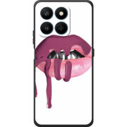 Чохол BoxFace Honor 400 Smart 