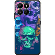 Чохол BoxFace Honor 400 Smart 