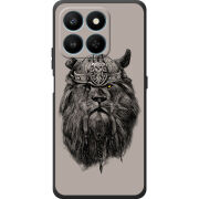 Чохол BoxFace Honor 400 Smart 