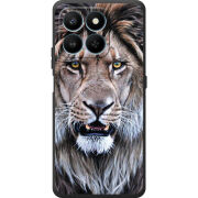 Чохол BoxFace Honor 400 Smart 