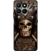 Чохол BoxFace Honor 400 Smart 