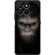Чохол BoxFace Honor 400 Smart 