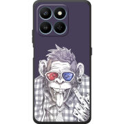 Чохол BoxFace Honor 400 Smart 