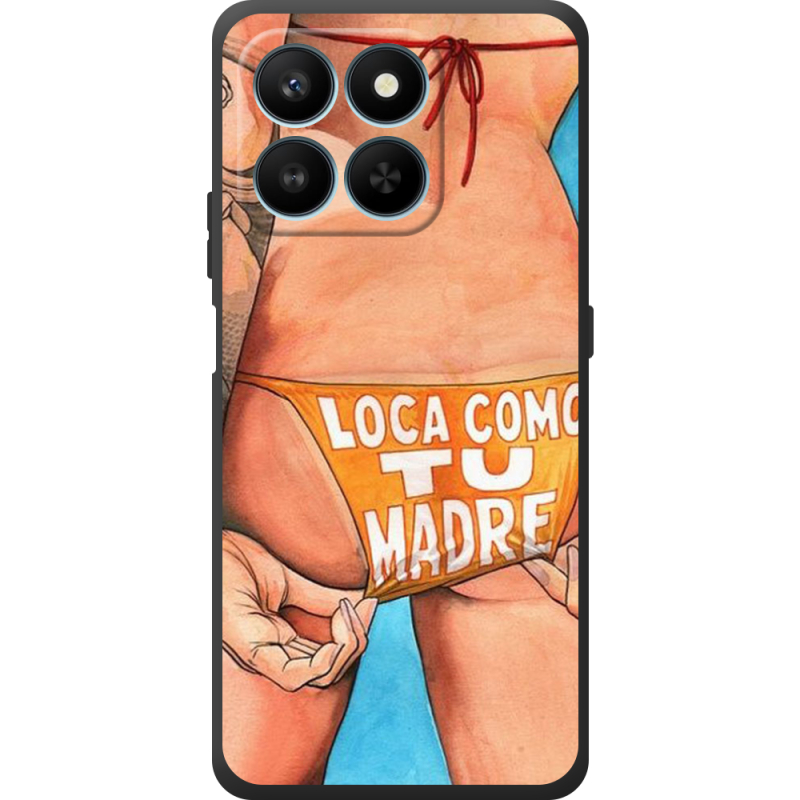 Чохол BoxFace Honor 400 Smart 