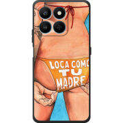 Чохол BoxFace Honor 400 Smart 