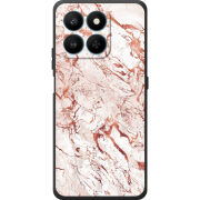 Чохол BoxFace Honor 400 Smart 