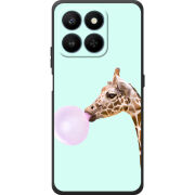 Чохол BoxFace Honor 400 Smart 