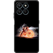Чохол BoxFace Honor 400 Smart 