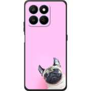 Чохол BoxFace Honor 400 Smart 