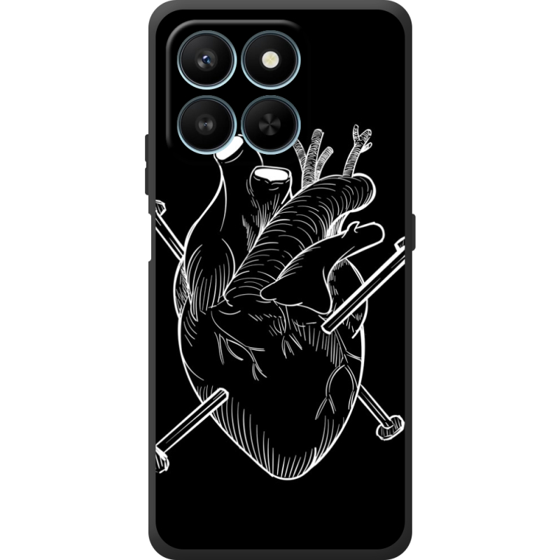 Чохол BoxFace Honor 400 Smart 