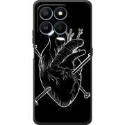 Чохол BoxFace Honor 400 Smart 