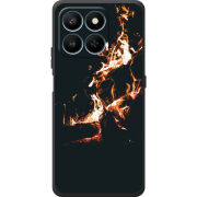 Чохол BoxFace Honor 400 Smart 