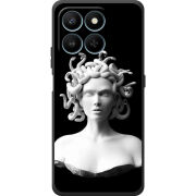 Чохол BoxFace Honor 400 Smart 