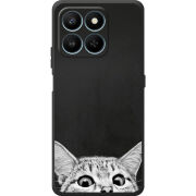 Чохол BoxFace Honor 400 Smart 