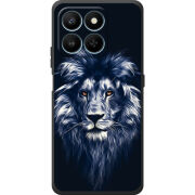 Чохол BoxFace Honor 400 Smart 