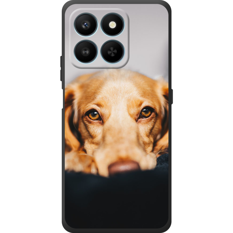 Чохол BoxFace Honor 400 Smart 