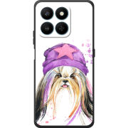 Чохол BoxFace Honor 400 Smart 