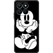 Чохол BoxFace Honor 400 Smart 