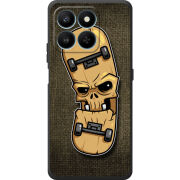Чохол BoxFace Honor 400 Smart 