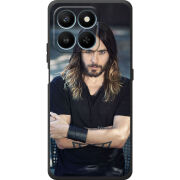 Чохол BoxFace Honor 400 Smart 