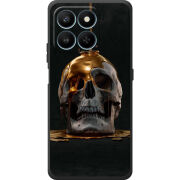 Чохол BoxFace Honor 400 Smart 