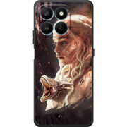 Чохол BoxFace Honor 400 Smart 