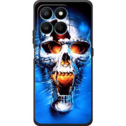 Чохол BoxFace Honor 400 Smart 