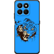 Чохол BoxFace Honor 400 Smart 