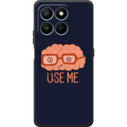 Чохол BoxFace Honor 400 Smart 