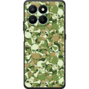 Чохол BoxFace Honor 400 Smart 