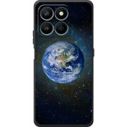 Чохол BoxFace Honor 400 Smart 
