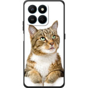 Чохол BoxFace Honor 400 Smart 