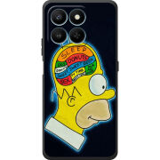Чохол BoxFace Honor 400 Smart 