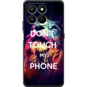 Чохол BoxFace Honor 400 Smart 
