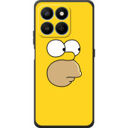 Чохол BoxFace Honor 400 Smart 