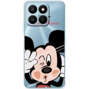 Прозорий чохол BoxFace Honor 400 Smart Mister M