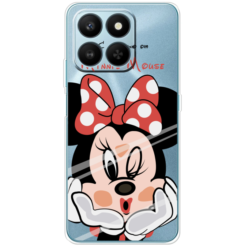 Прозорий чохол BoxFace Honor 400 Smart Lady M